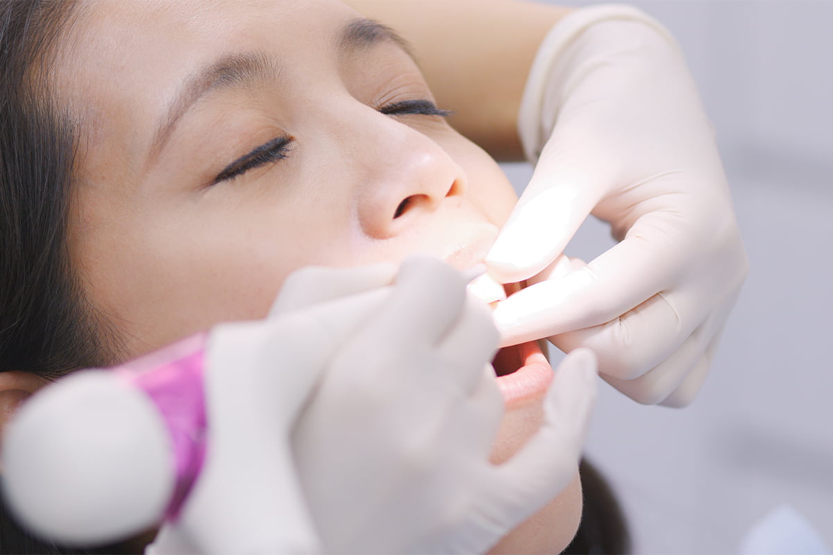 dental-emergency