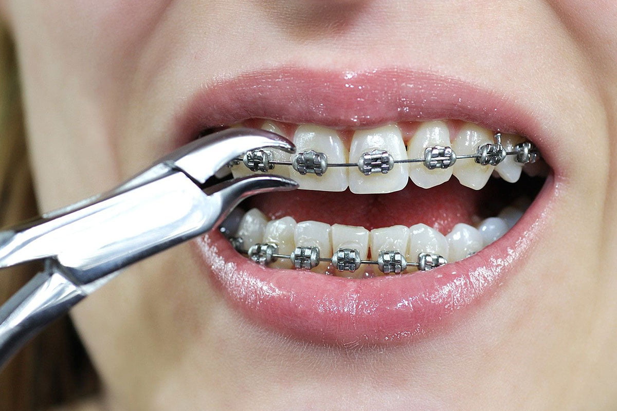 Broken Orthodontics
