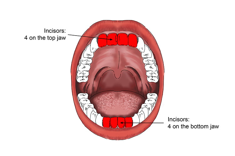 Cosmetic Orthodontic