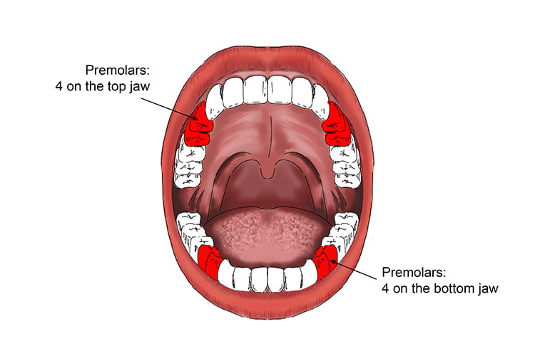 Cosmetic Orthodontic